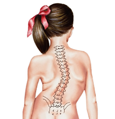 spinal fusion tattooTikTok Search