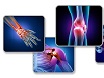 orthobiologics can promote tissue healing to eliminate joint pain