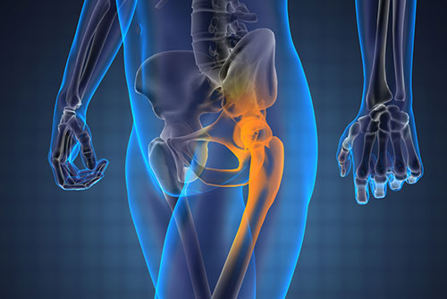 Common Causes of Hip Pain Lincoln NE