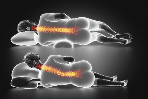 How Sleep Position Affects Your Spine