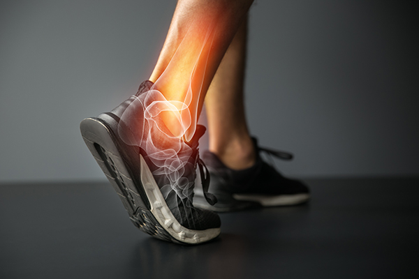 Ankle Replacement — Ankle Arthritis, Ankle Replacement, Arthrodesis