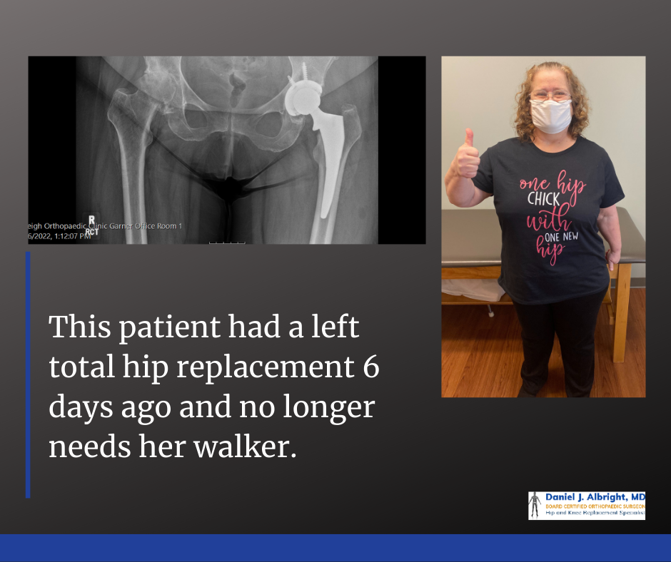 total hip replacement patient walking 