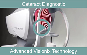 Cataract Diagnostic Tech