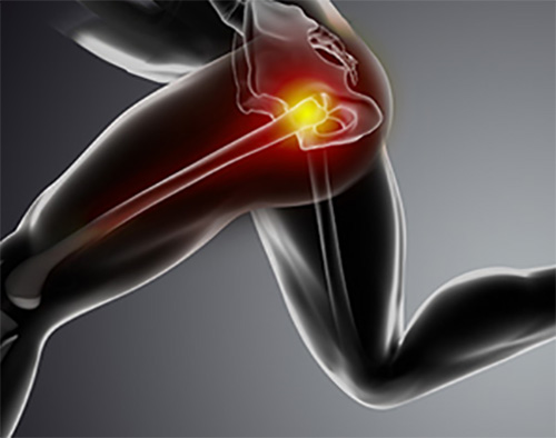 Can a short leg cause knee or hip pain?